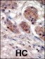 PI4K2A  (PI4K II) Antibody (N-term)